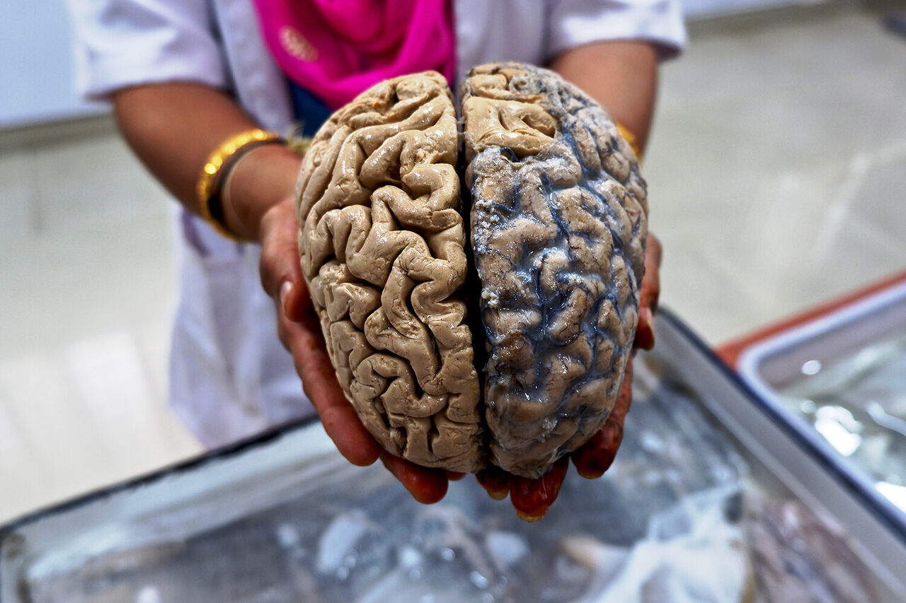 Visitors Can Touch Human Brains at This Indian Neuroscience Institute